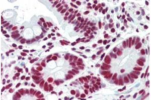 Human Small Intestine (formalin-fixed, paraffin-embedded) stained with ACIN1 antibody ABIN461879 at 5 ug/ml followed by biotinylated goat anti-rabbit IgG secondary antibody ABIN481713, alkaline phosphatase-streptavidin and chromogen.