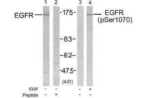 Image no. 2 for anti-Epidermal Growth Factor Receptor (EGFR) (pSer1070) antibody (ABIN196758) (EGFR antibody  (pSer1070))