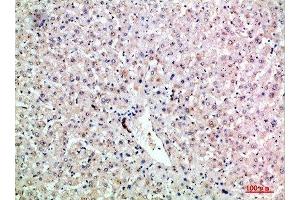 Immunohistochemical analysis of paraffin-embedded human-liver, antibody was diluted at 1:200 (LTB antibody  (AA 41-90))
