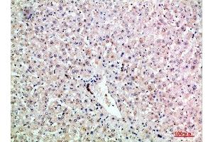 Immunohistochemical analysis of paraffin-embedded human-liver, antibody was diluted at 1:200 (LTB antibody  (AA 41-90))