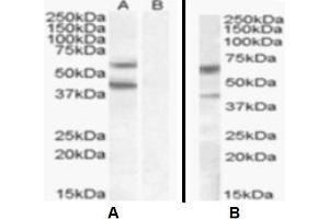 Western Blotting (WB) image for anti-Diacylglycerol O-Acyltransferase 2 (DGAT2) (Internal Region) antibody (ABIN2465597)