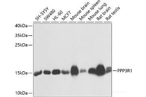 Western blot analysis of extracts of various cell lines using PPP3R1 Polyclonal Antibody at dilution of 1:1000. (PPP3R1 antibody)