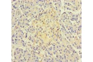 Immunohistochemistry of paraffin-embedded human pancreatic tissue using ABIN7171466 at dilution of 1:100 (TSNARE1 antibody  (AA 6-339))