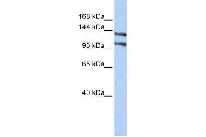 Western Blotting (WB) image for anti-RNA Binding Motif Protein 5 (RBM5) antibody (ABIN2458330) (RBM5 antibody)