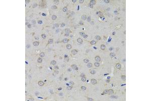 Immunohistochemistry of paraffin-embedded rat brain using AMPD1 antibody (ABIN5995393) (40x lens).