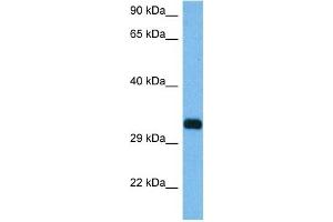 Host:  Mouse  Target Name:  RIMS3  Sample Tissue:  Mouse Pancreas  Antibody Dilution:  1ug/ml (RIMS3 antibody  (C-Term))