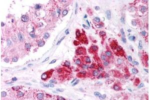 Human Testis (formalin-fixed, paraffin-embedded) stained with EIF4G2 antibody ABIN214749 at 5 ug/ml followed by biotinylated goat anti-rabbit IgG secondary antibody ABIN481713, alkaline phosphatase-streptavidin and chromogen. (EIF4G2 antibody  (AA 766-815))