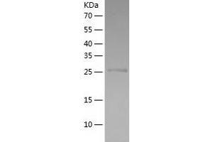 Western Blotting (WB) image for Integrin alpha M (ITGAM) (AA 567-825) protein (His tag) (ABIN7285288) (CD11b Protein (AA 567-825) (His tag))