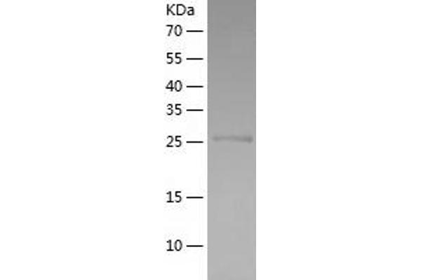CD11b Protein (AA 567-825) (His tag)