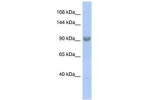 Image no. 1 for anti-Squamous Cell Carcinoma Antigen Recognized By T Cells 3 (SART3) (AA 827-876) antibody (ABIN6742461) (SART3 antibody  (AA 827-876))