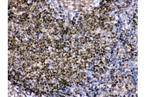Immunohistochemistry (IHC) image for anti-Paired Box Gene 2a (PAX2A) (AA 248-282), (C-Term) antibody (ABIN3043591)