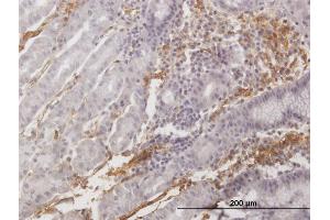 Immunoperoxidase of purified MaxPab antibody to AOC3 on formalin-fixed paraffin-embedded human stomach. (AOC3 antibody  (AA 1-763))