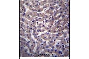 PTGR2 Antibody (N-term) (ABIN656796 and ABIN2846015) immunohistochemistry analysis in formalin fixed and paraffin embedded human liver tissue followed by peroxidase conjugation of the secondary antibody and DAB staining. (PTGR2 antibody  (N-Term))