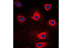 Immunofluorescent analysis of PERK staining in HeLa cells. (PERK antibody  (N-Term))