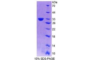 SDS-PAGE (SDS) image for Phospholipase C, delta 4 (PLCD4) (AA 1-250) protein (His tag) (ABIN4990051)