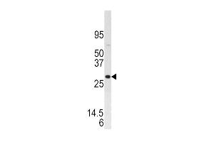 Western blot analysis of anti-DUSP3 Pab (ABIN392924 and ABIN2842297) in SK-BR-3 cell line lysate.