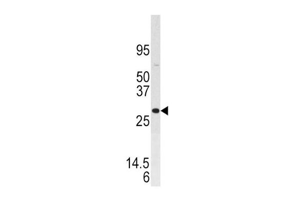 Dual Specificity Phosphatase 3 (DUSP3) (AA 1-30), (N-Term) antibody