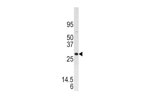 Dual Specificity Phosphatase 3 (DUSP3) (AA 1-30), (N-Term) anticorps