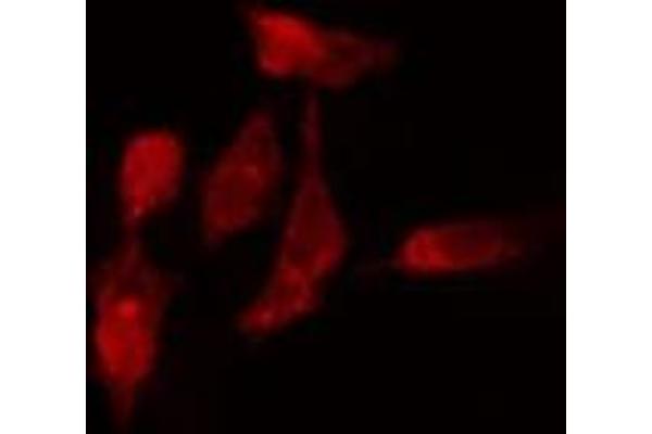 RPL7L1 antibody  (Internal Region)