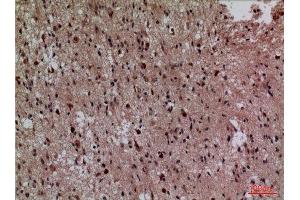 Immunohistochemistry (IHC) analysis of paraffin-embedded Human Brain, antibody was diluted at 1:100. (CDK4 antibody  (N-Term))