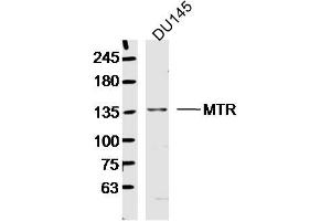 DU145 lysates probed with MTR Polyclonal Antibody, Unconjugated  at 1:300 dilution and 4˚C overnight incubation.