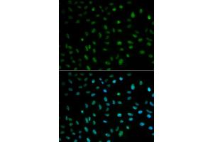 Immunofluorescence analysis of MCF-7 cells using ELAVL1 antibody. (ELAVL1 antibody)