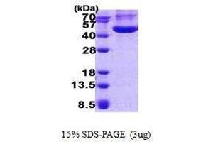 Figure annotation denotes ug of protein loaded and % gel used. (CHI3L1 Protein)