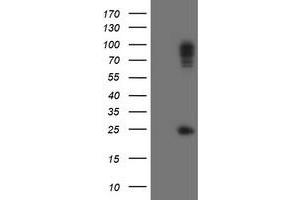 Image no. 1 for anti-Spastic Paraplegia 7 (SPG7) (AA 300-573) antibody (ABIN1491370) (SPG7 antibody  (AA 300-573))