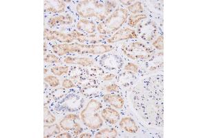 Immunohistochemical analysis of (ABIN656123 and ABIN2845462) on paraffin-embedded human kidney tissue was performed on the Leica®BOND RXm.
