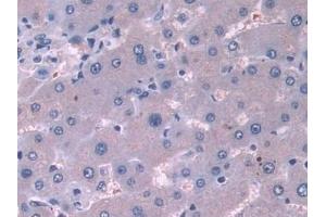 Detection of CTTN in Mouse Liver Tissue using Polyclonal Antibody to Cortactin (CTTN) (Cortactin antibody  (AA 1-509))