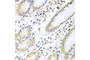 Immunohistochemistry of paraffin-embedded human stomach using IL5 antibody (ABIN5975164) at dilution of 1/100 (40x lens). (IL-5 antibody)