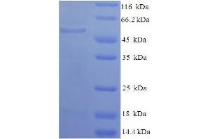 SDS-PAGE (SDS) image for Glycerol-3-Phosphate Dehydrogenase 1 (Soluble) (GPD1) (AA 1-349), (full length) protein (His-SUMO Tag) (ABIN5709607) (GPD1 Protein (AA 1-349, full length) (His-SUMO Tag))