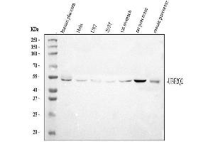 Western blot analysis of UBE2Q2 using anti-UBE2Q2 antibody (ABIN3043953). (UBE2Q2 antibody  (N-Term))