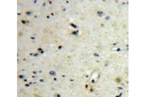 #VALUE! (CGB antibody  (AA 31-165))
