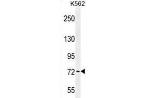 Western Blotting (WB) image for anti-P21-Activated Kinase 6 (PAK6) antibody (ABIN2996561)