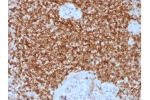 Formalin-fixed, paraffin-embedded human Spleen stained with Bcl-2 Rabbit Recombinant Monoclonal Antibody (BCL2/1878R). (Recombinant Bcl-2 antibody)