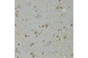 Immunohistochemistry of paraffin-embedded rat spinal cord using NLK antibody (ABIN1873910) at dilution of 1:100 (40x lens).