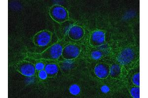 Confocal image of mixed neuron-glial cultures stained with SPTAN1 / Alpha Fodrin antibody antibody to alpha-II spectrin (green) and counterstained for DNA (blue). (SPTAN1 antibody  (AA 1398-1685))