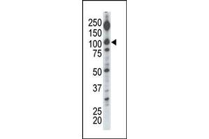 Image no. 2 for anti-Diacylglycerol Kinase, iota (DGKI) (C-Term) antibody (ABIN360602) (DGKI antibody  (C-Term))