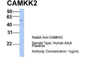 Host: Rabbit  Target Name: CAMKK2  Sample Tissue: Human Adult Placenta  Antibody Dilution: 1. (CAMKK2 antibody  (N-Term))
