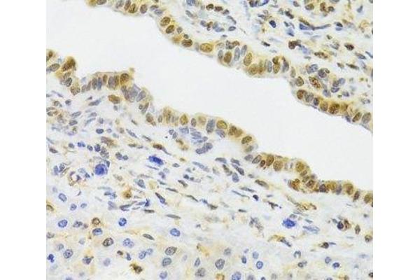 EFTUD2 antibody