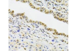 Immunohistochemistry of paraffin-embedded Rat liver using EFTUD2 Polyclonal Antibody at dilution of 1:100 (40x lens).