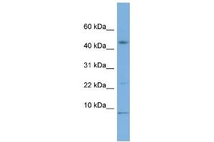 WB Suggested Anti-MIF Antibody Titration: 0. (MIF antibody  (Middle Region))