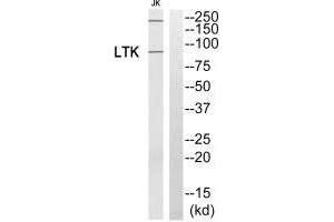 Western blot analysis of extracts from Jurkat cells, using LTK antibody. (LTK antibody)