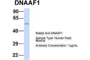 Host: Rabbit  Target Name: DNAAF1  Sample Tissue: Human Fetal Muscle  Antibody Dilution: 1. (LRRC50 antibody  (N-Term))