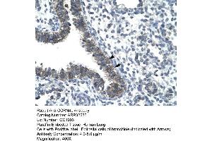 Human Lung (CCRN4L antibody  (N-Term))