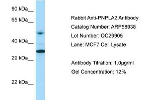 Western Blotting (WB) image for anti-Patatin-Like phospholipase Domain Containing 2 (PNPLA2) (Middle Region) antibody (ABIN2787884) (PNPLA2 antibody  (Middle Region))