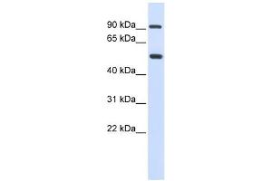 LOXL1 antibody used at 1 ug/ml to detect target protein. (LOXL1 antibody  (Middle Region))