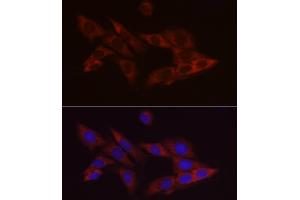 Immunofluorescence analysis of PC-12 cells using Bcl-2 Mouse mAb (ABIN7265809) at dilution of 1:100 (40x lens). (Bcl-2 antibody)