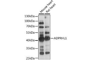 Western blot analysis of extracts of various cell lines, using ADPRHL1 antibody (ABIN6292800) at 1:1000 dilution. (ADPRHL1 antibody)